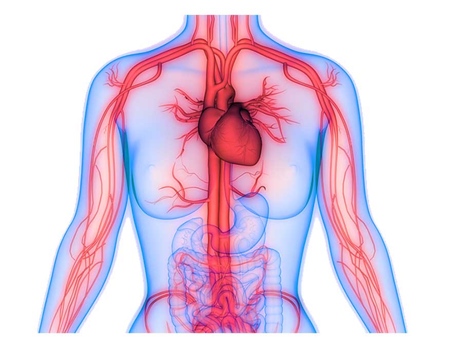 Angiography